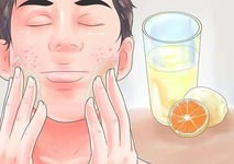 Sivilce Limon Kullanımı ve Faydaları Nelerdir? Sivilce Limon Kullanımı ve Faydaları Nelerdir?